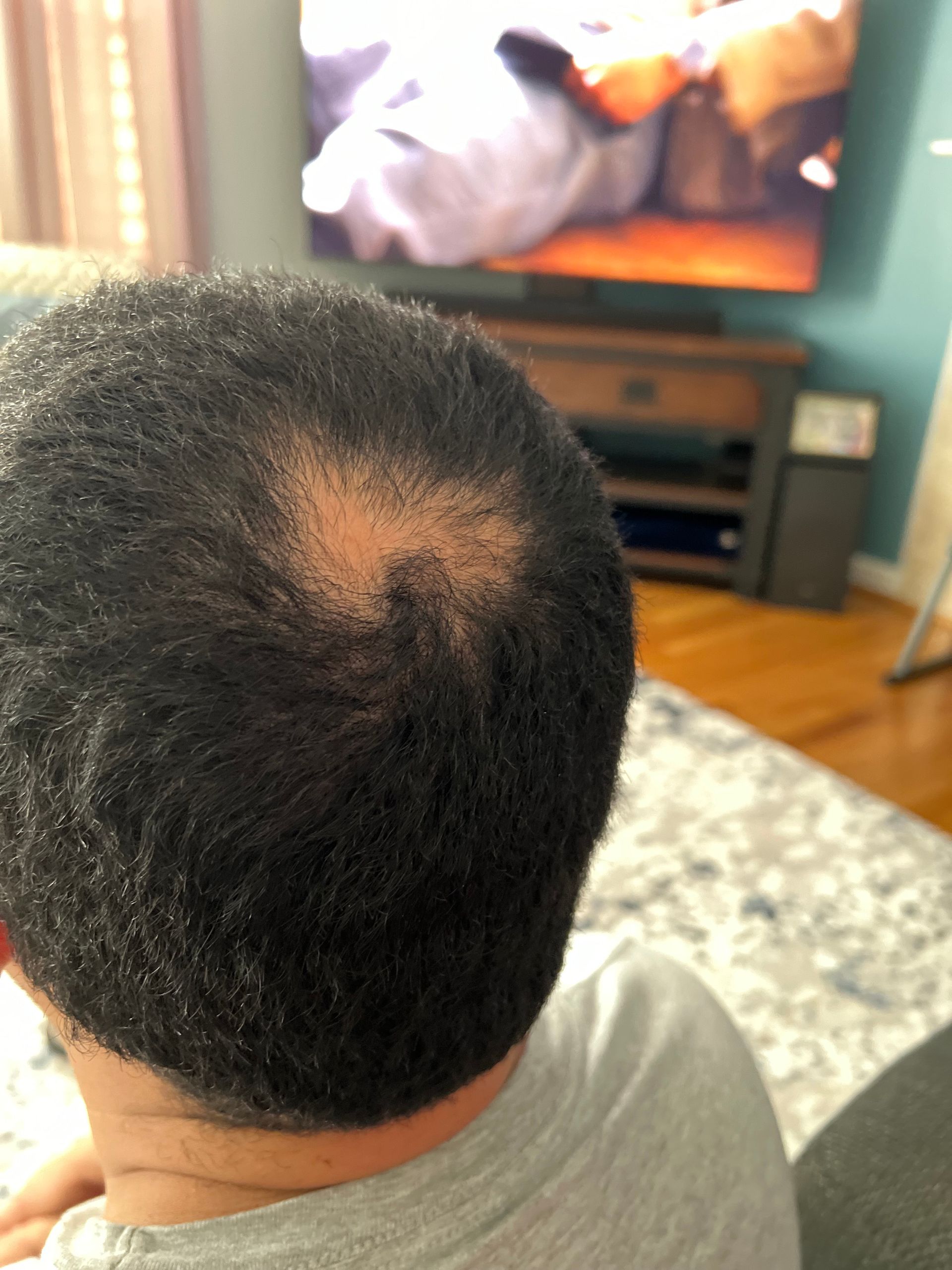 Man with short, dark hair and thinning spot on the crown of his head, sitting indoors.