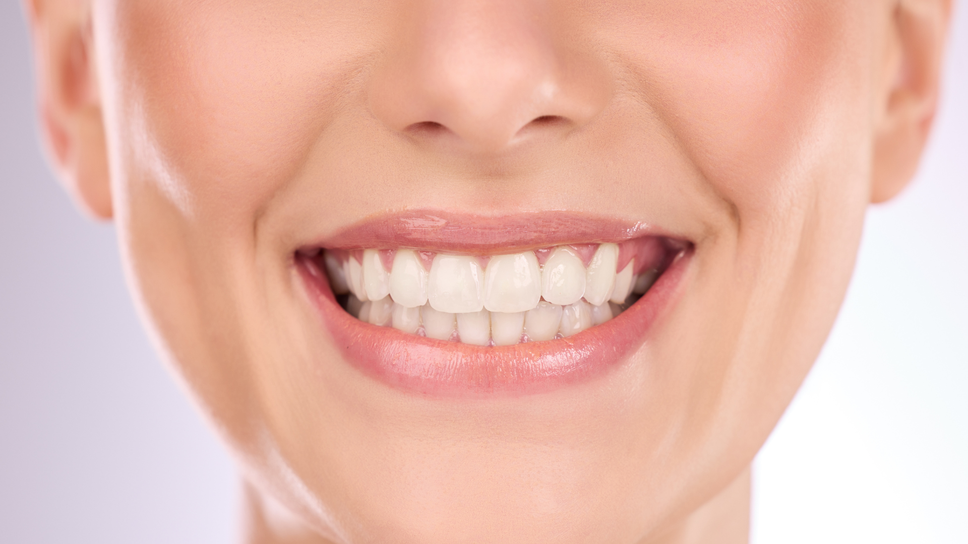 A close up of a woman 's smile with white teeth.