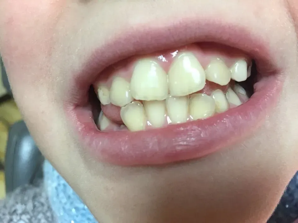 bocca in primo piano - ortodonzia