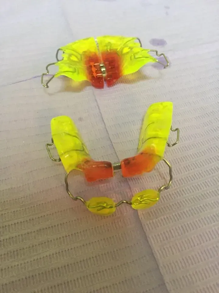 apparecchio ortodontico