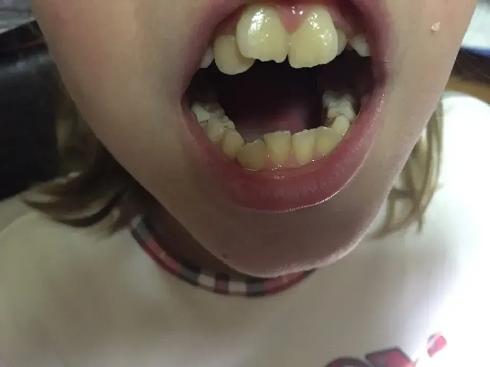 bocca in primo piano - ortodonzia