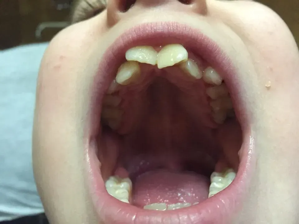 bocca in primo piano - ortodonzia