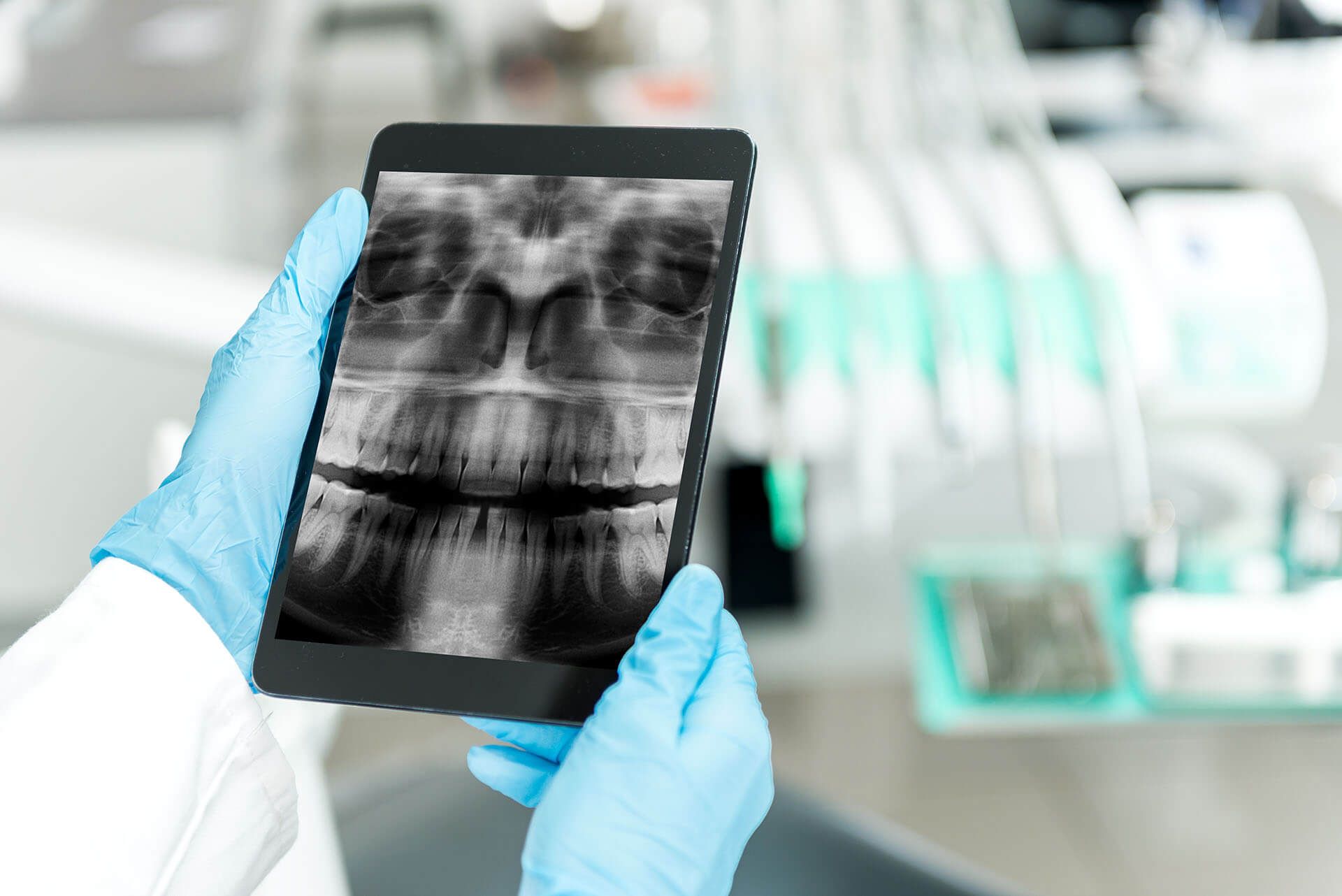 Un dentista tiene in mano una tavoletta con sopra una radiografia dei denti di una persona.
