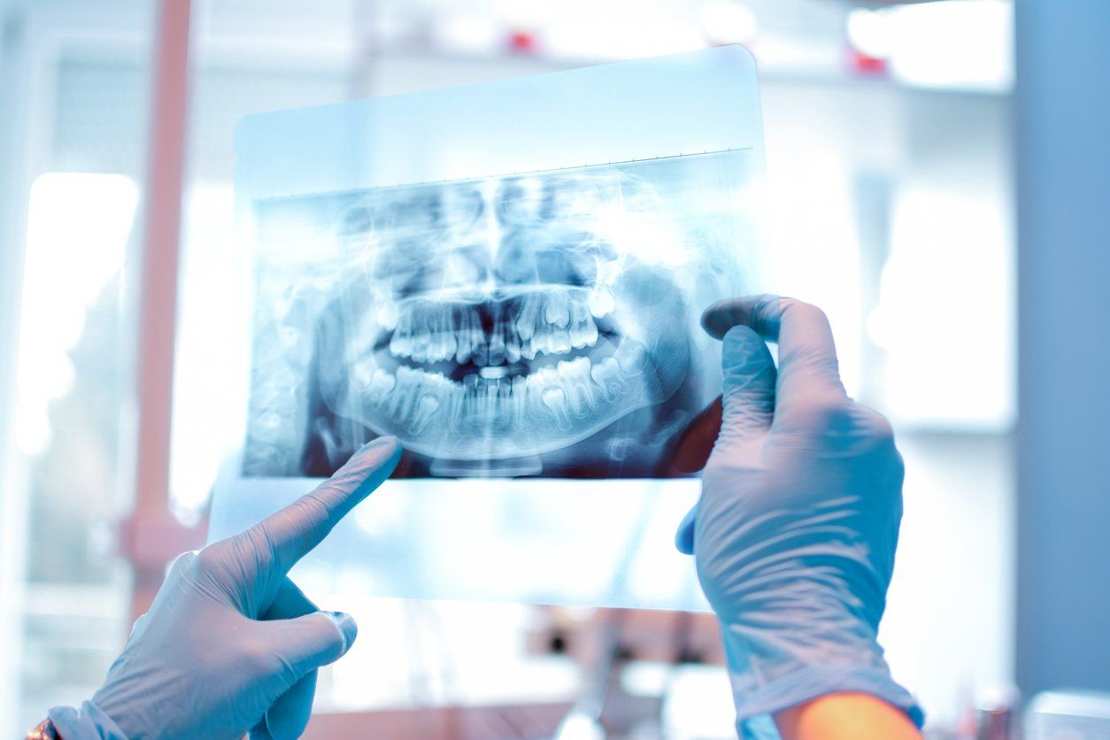 A dentist is holding an x-ray of a patient 's teeth.