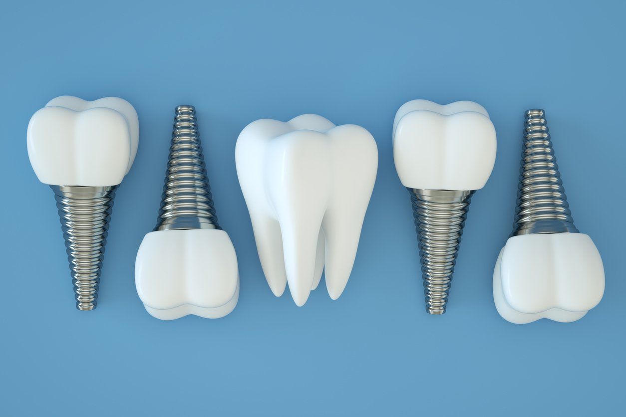 A row of tooth implants on a blue background