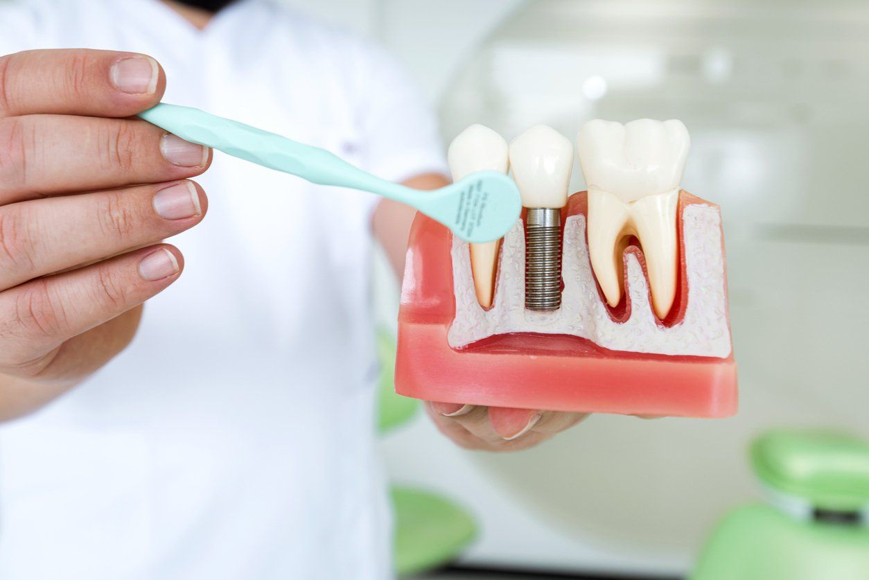 A dentist is brushing a model of teeth with a toothbrush.