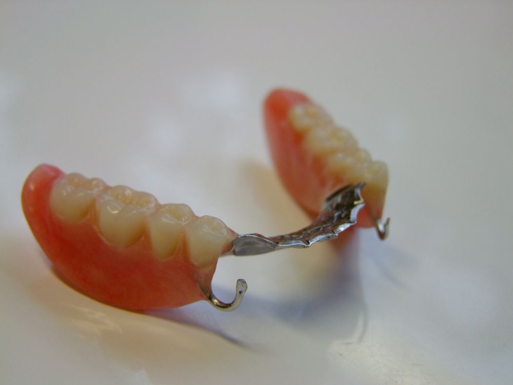 Partial Dentures With Pink Base — My Denture Clinic in Inverell, NSW