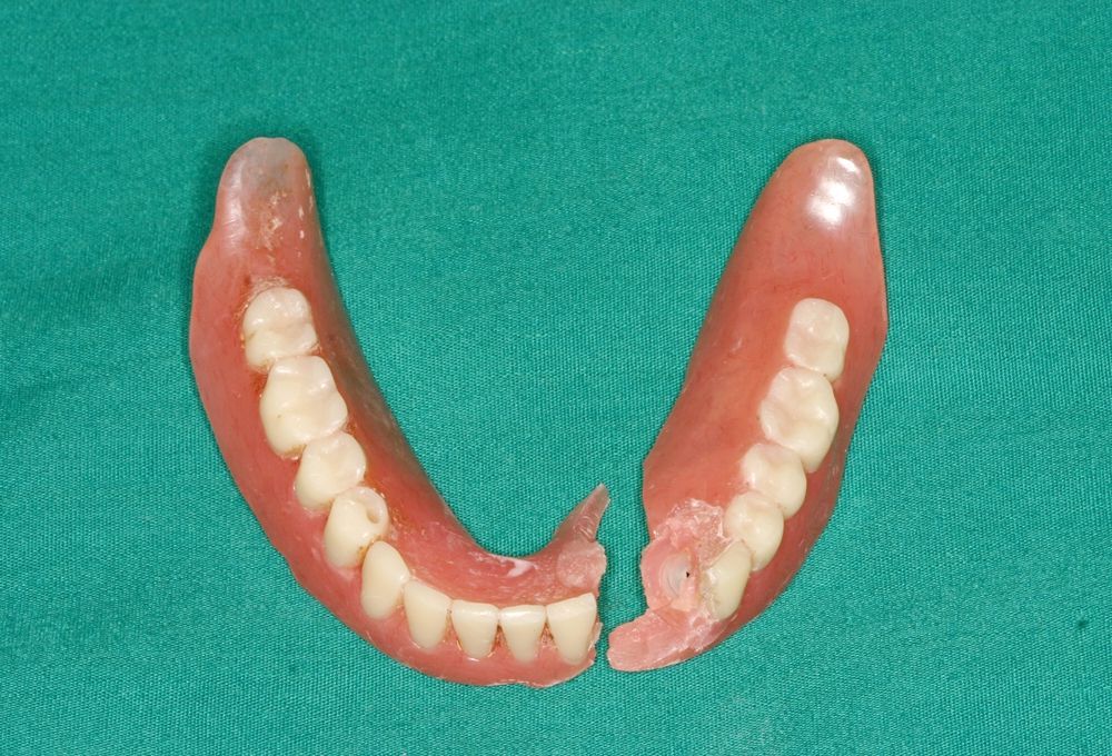 Broken Dentures on a Green Surface — My Denture Clinic in Inverell, NSW