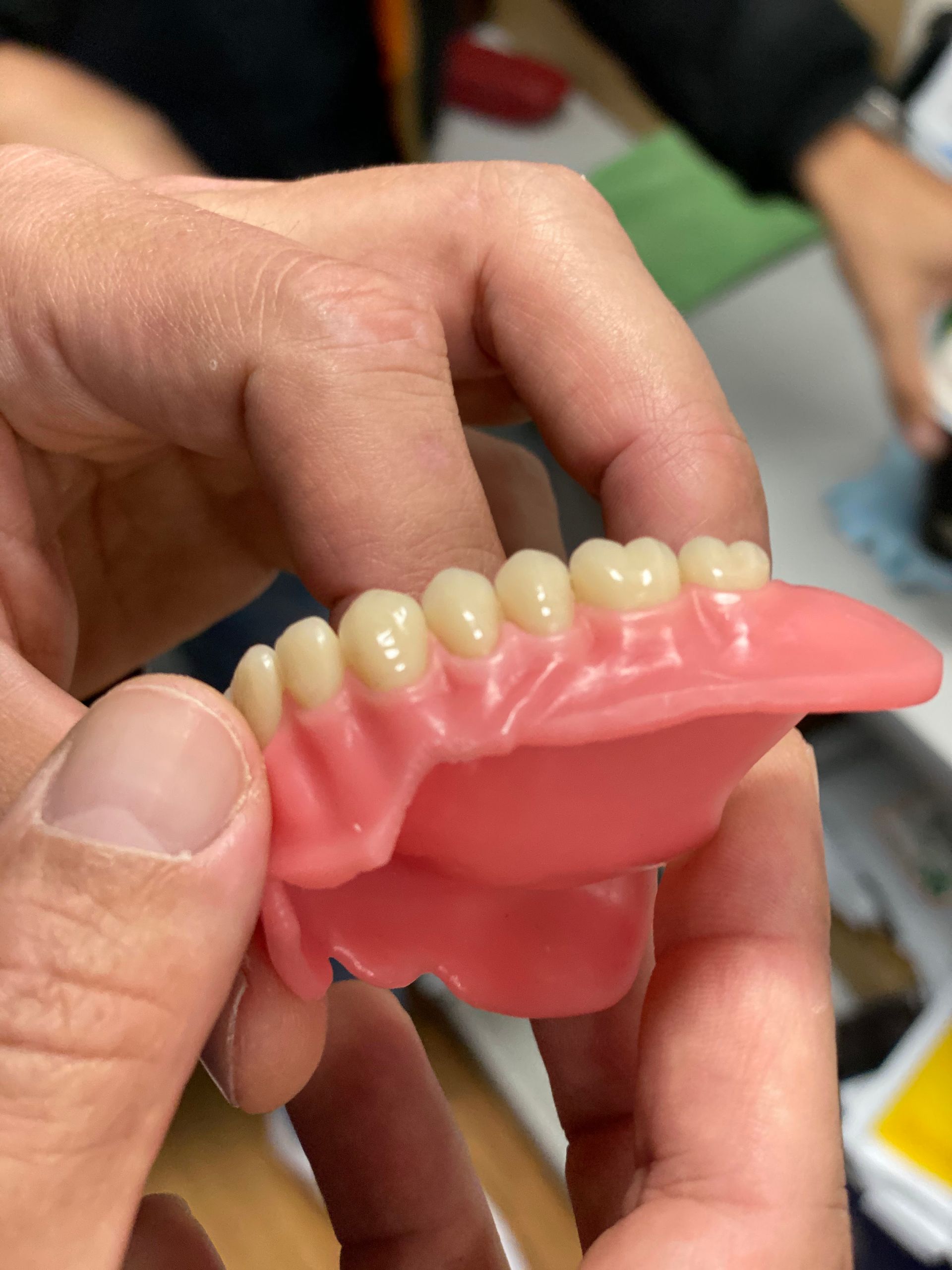 Hand Holding a Set of Upper Dentures β My Denture Clinic in Gold Coast, QLD