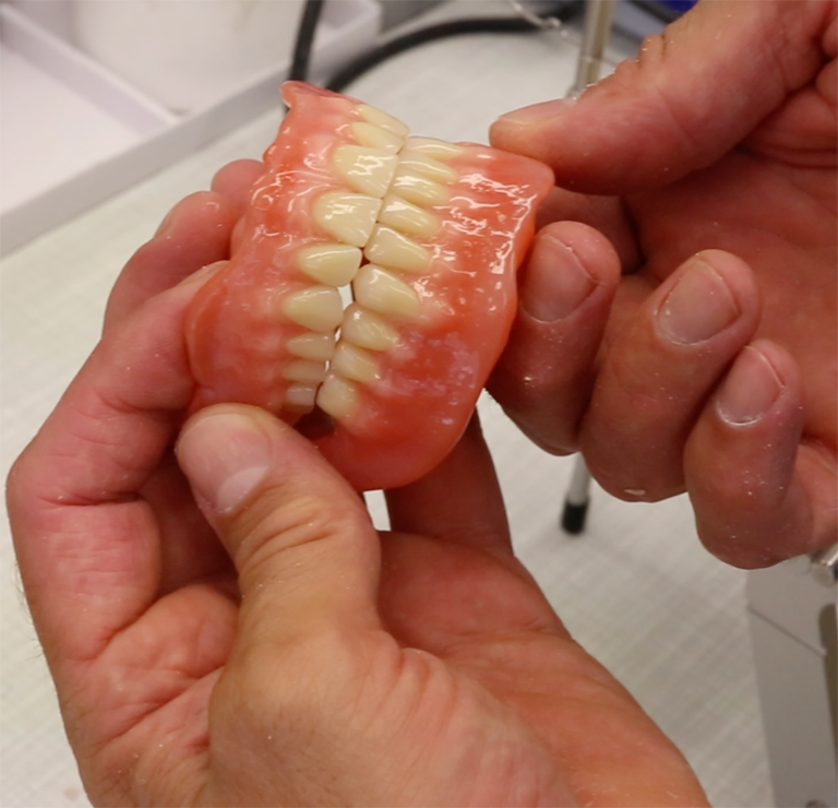 Hands Holding a Set of Upper and Lower Dentures — My Denture Clinic in Inverell, NSW