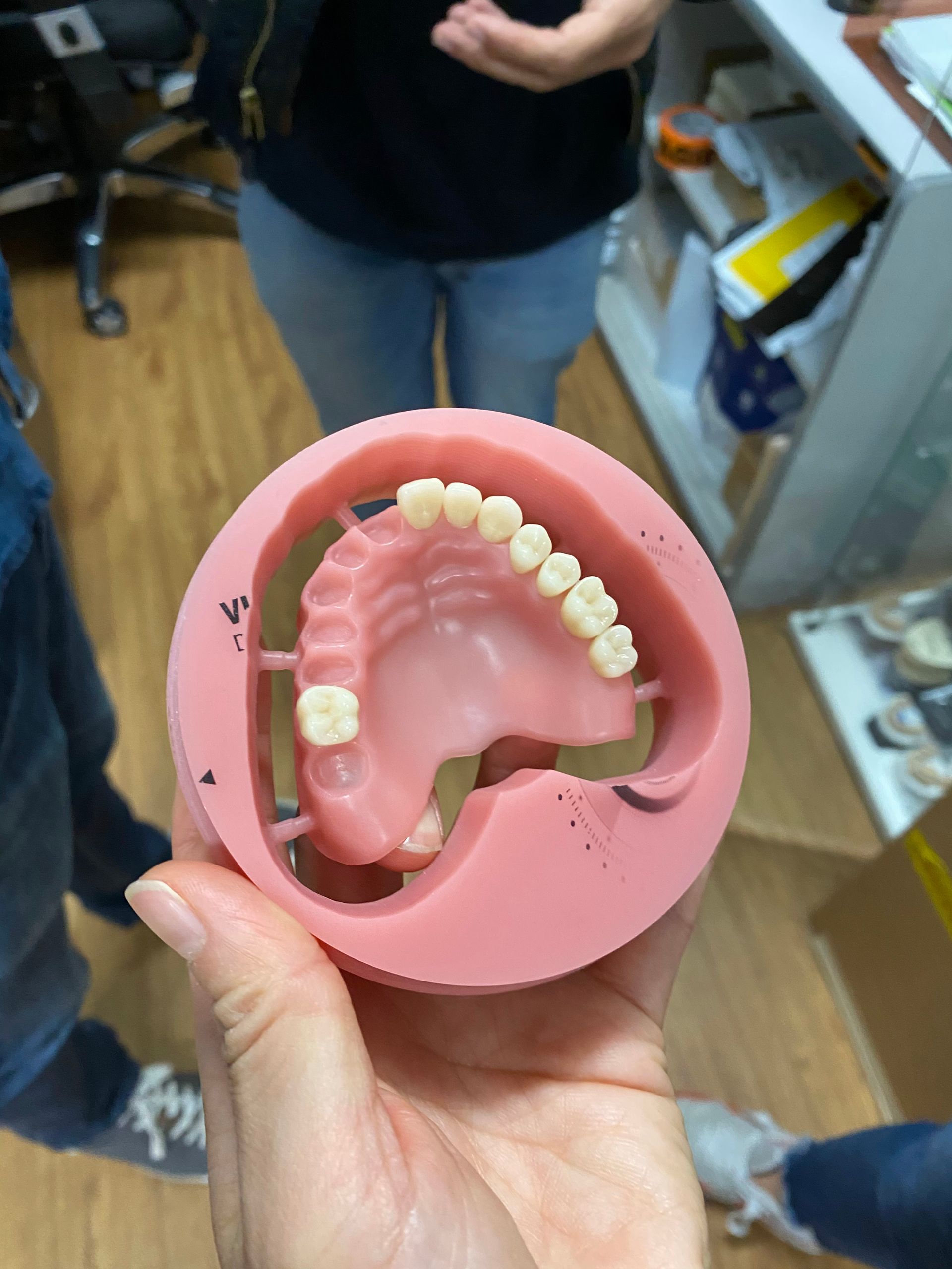 Person Holding a Dental Mold With Dentures — My Denture Clinic in Benowa, QLD