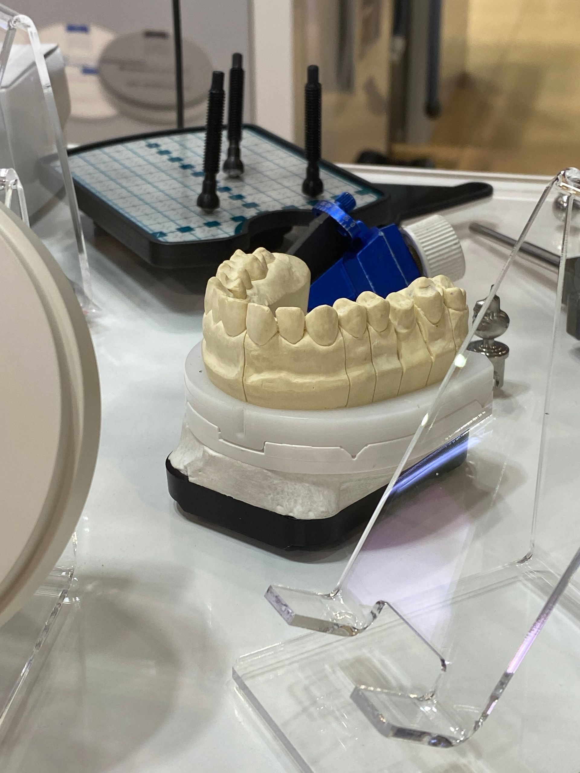 Dental Model of Teeth on a White and Black Stand With Tools — My Denture Clinic in Benowa, QLD