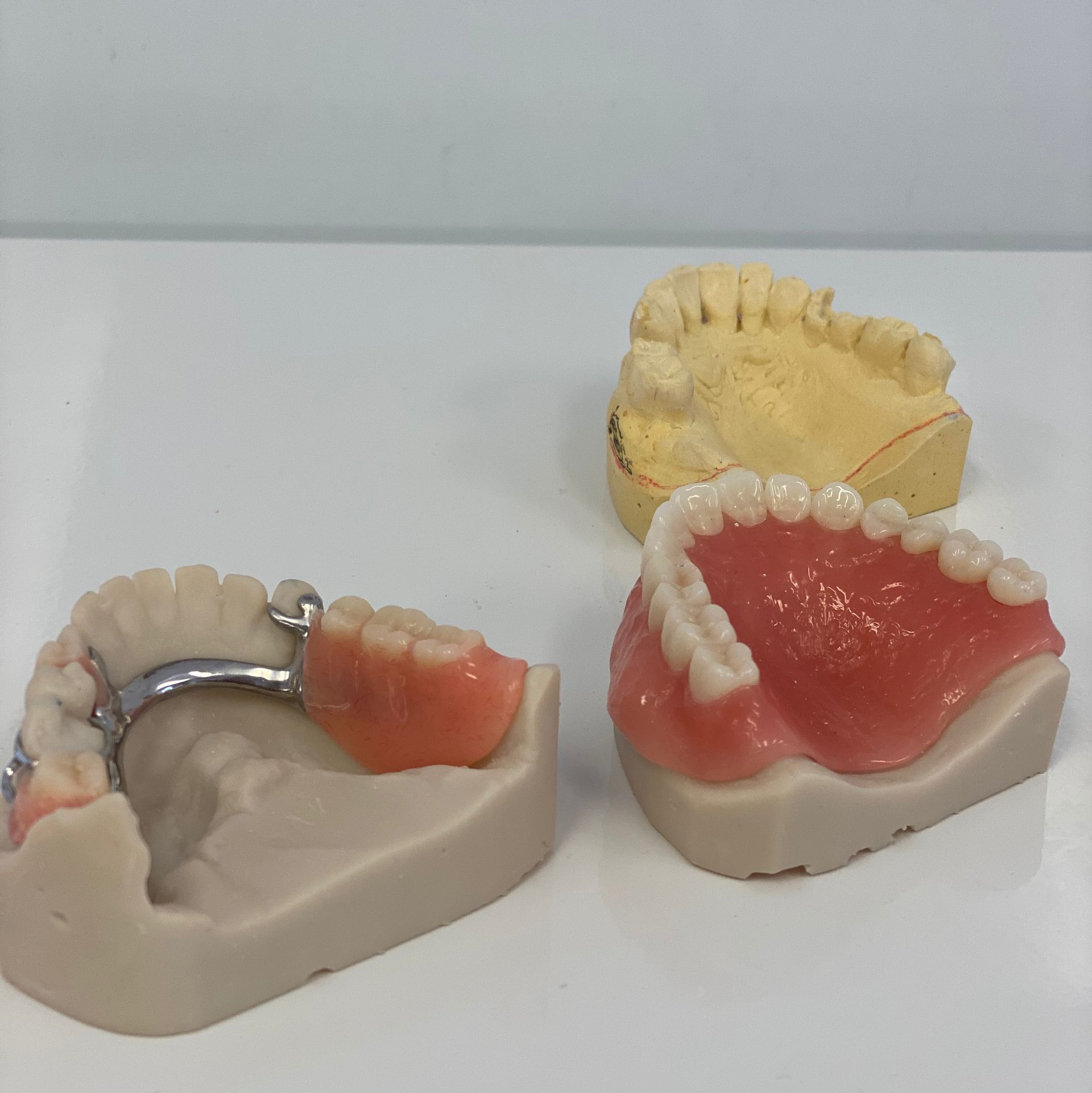Three Dental Prosthetics: a Partial, a Full Denture — My Denture Clinic in Benowa, QLD