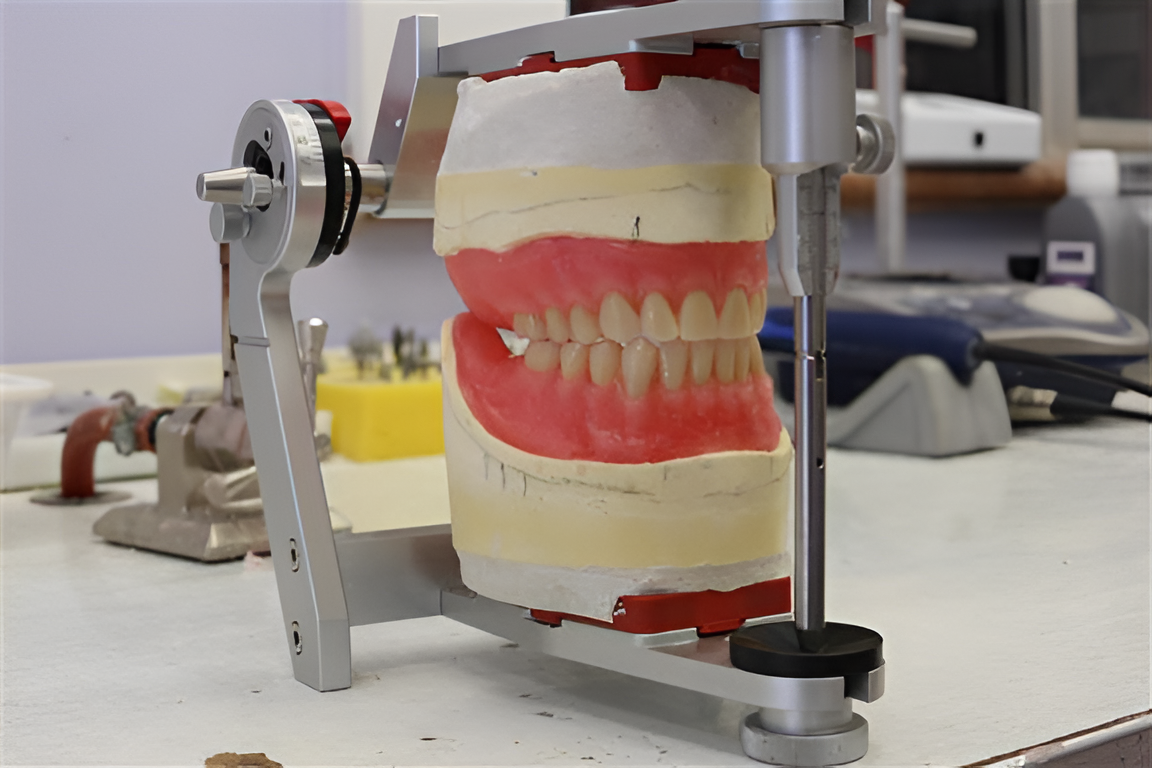Dental Model of Teeth Mounted on an Articulator for Dental Work — My Denture Clinic in Benowa, QLD
