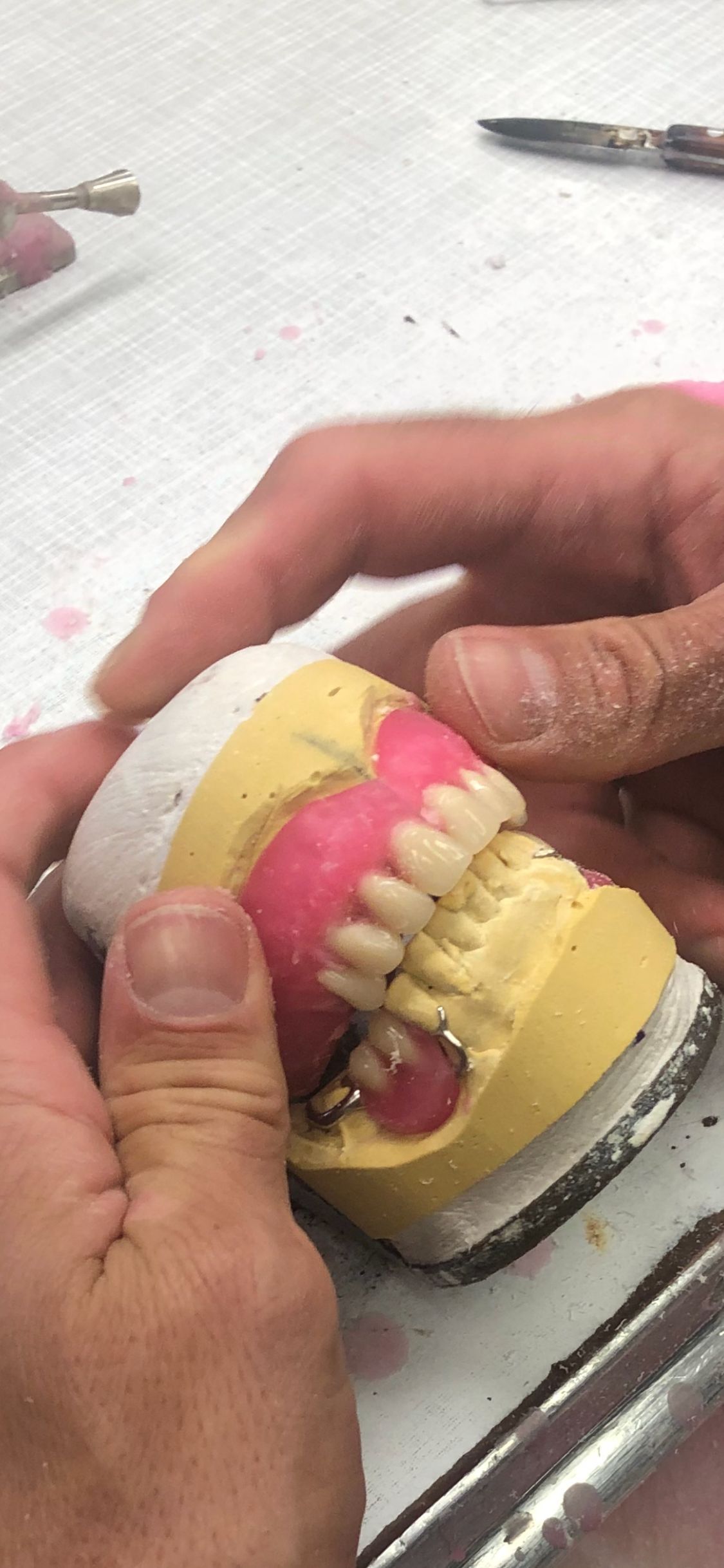 Dental Model With Teeth, Yellow Base, and Pink Gum Area — My Denture Clinic in Armidale, NSW