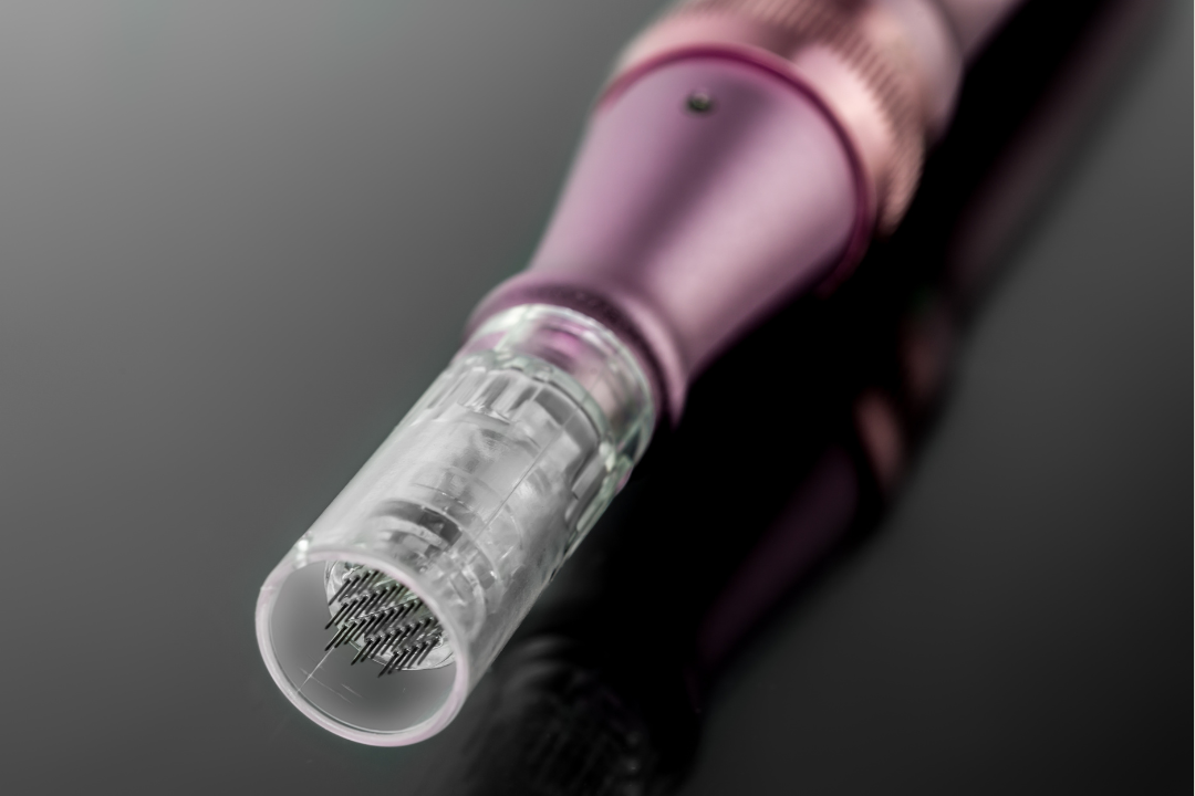 Microagujas o Microneedling