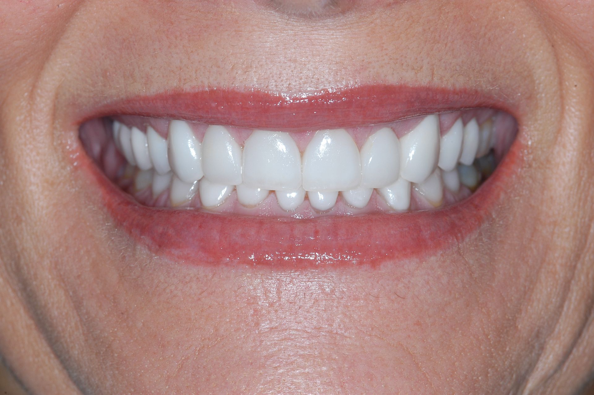 Cosmetic Dentistry — Auburndale, FL — Dwight H. Pate DMD PA