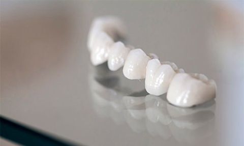 Zirconium Porcelain Tooth — Washington, PA — Snee Dental Associates