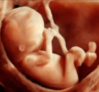 ecografia di un feto 3D
