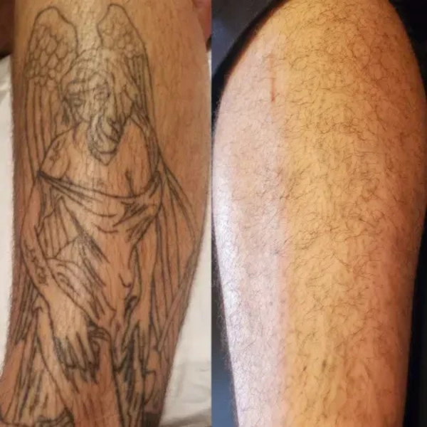 A before and after picture of a tattoo on a person 's leg