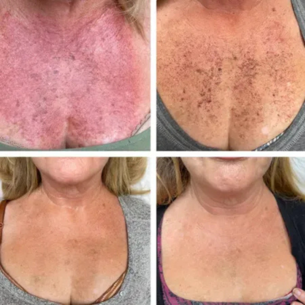 A collage of four pictures of a woman 's chest and neck