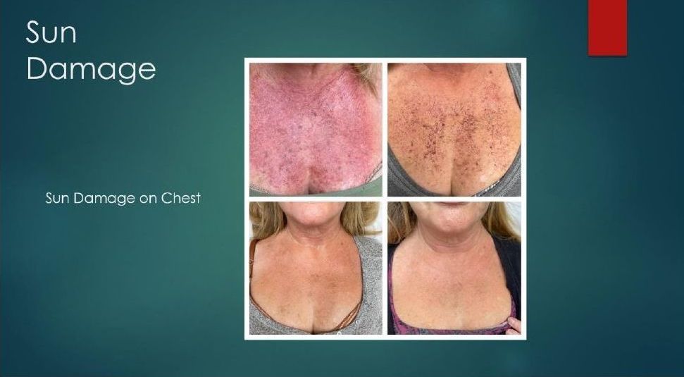 A collage of four pictures of a woman 's chest and neck.