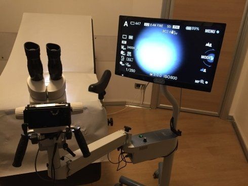 Primo piano dell'apparecchio di echography