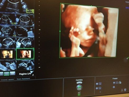 Echography tridimensionale del bambino e un primo piano spettacolare