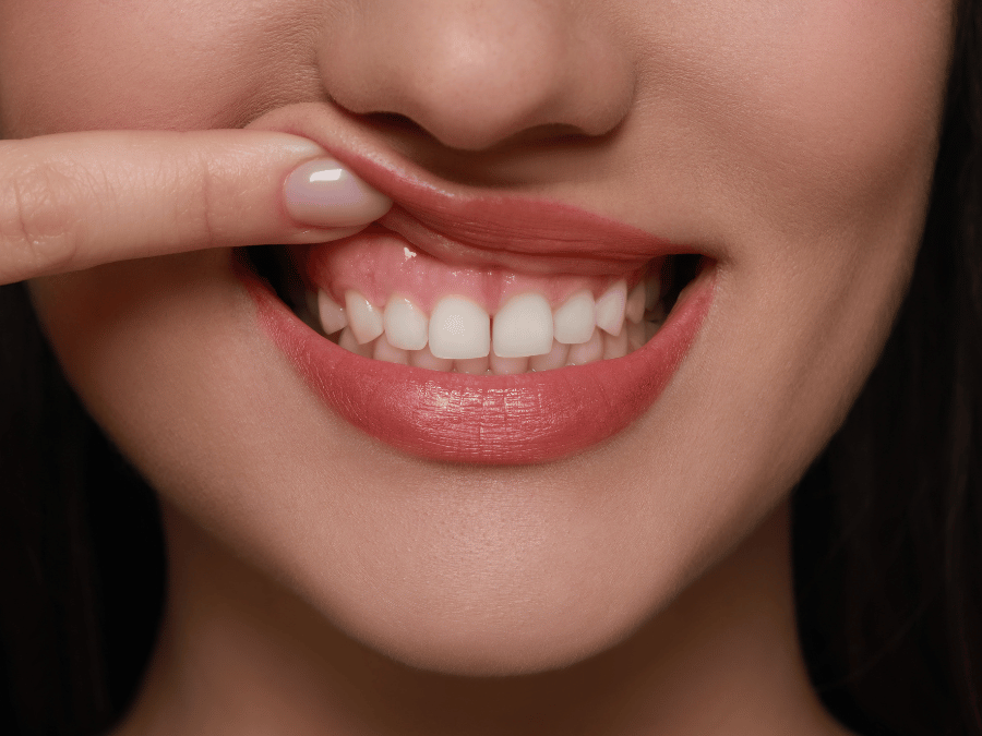 A woman with white teeth Hammond Indiana 