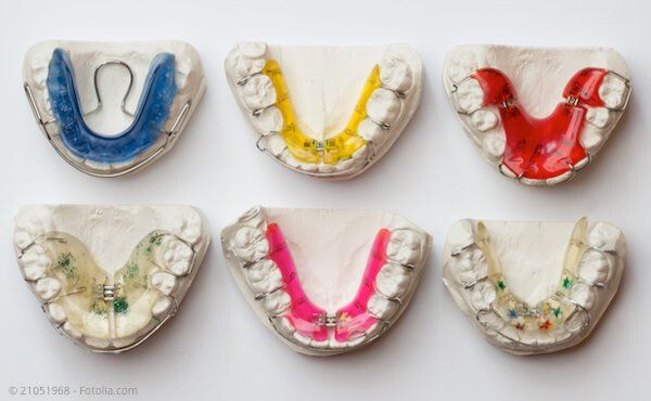 Zahnspangen-Herstellung im eigenen Labor