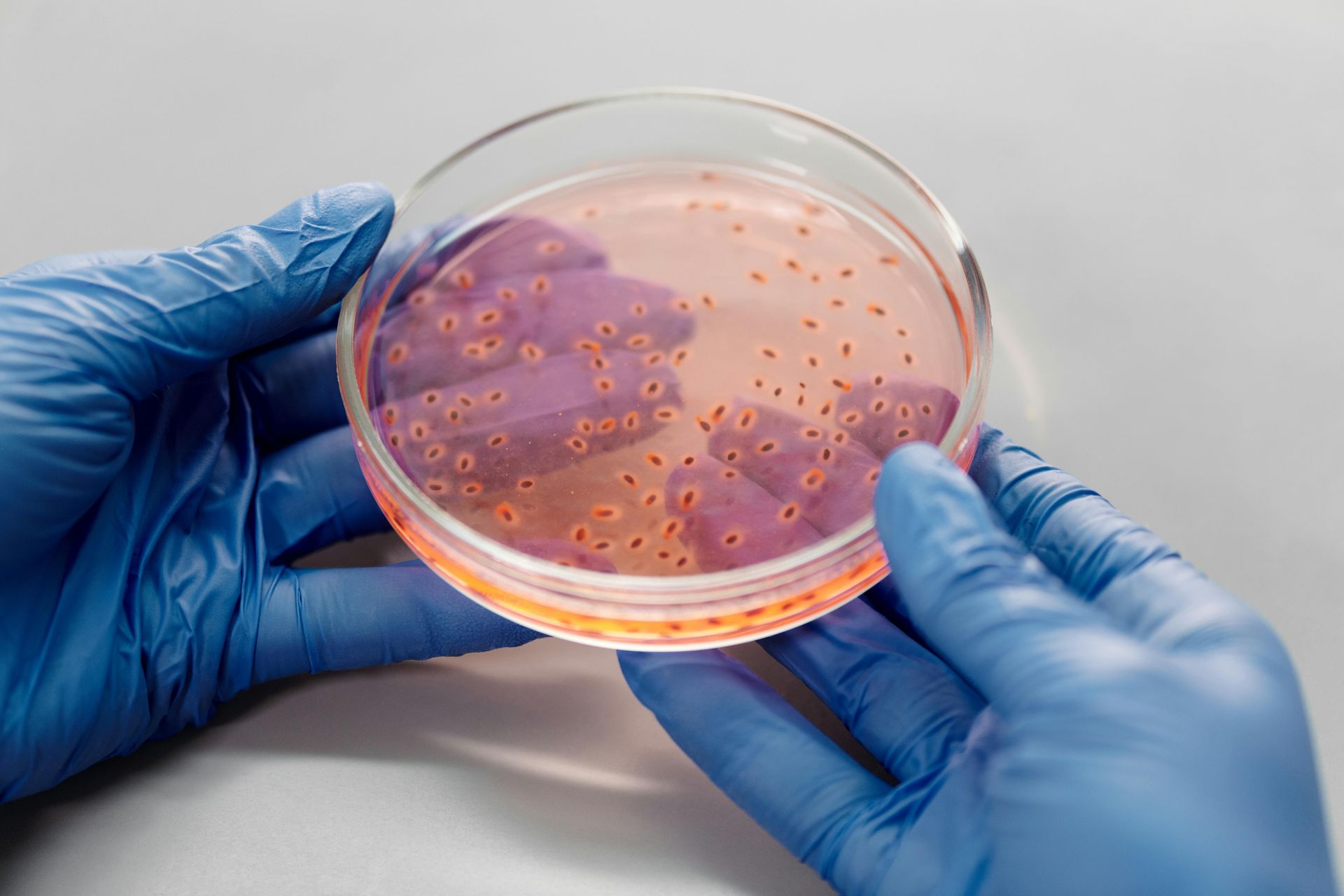 Hands in blue gloves holding a petri dish containing purple colonies and scattered orange-red dots.