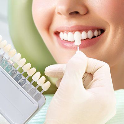 Cosmetological Teeth Whitening — Newton, SA — Arena Dental