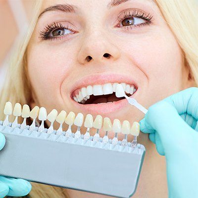 Dental Veneers — Newton, SA — Arena Dental