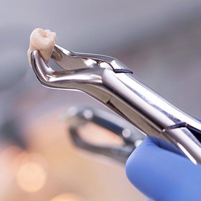 Tooth Extractions — Newton, SA — Arena Dental