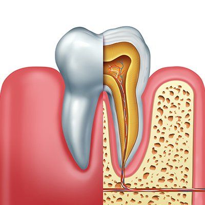 Human Root Canal Treatment — Newton, SA — Arena Dental
