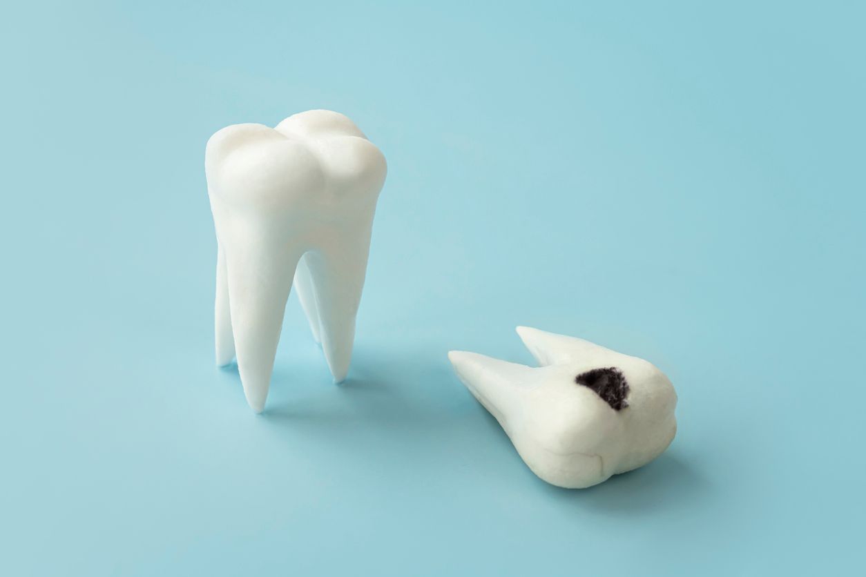 A tooth with a hole in it and a tooth without a hole in it on a blue background.