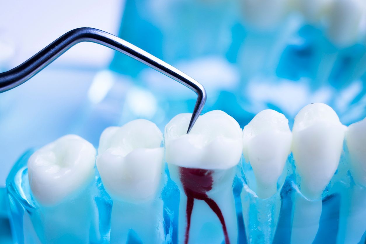 A close up of a model of teeth being examined by a dentist.