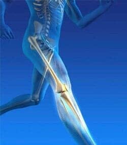 DR. ALFREDO PENAGOS PANIAGUA - CARTILAGOS