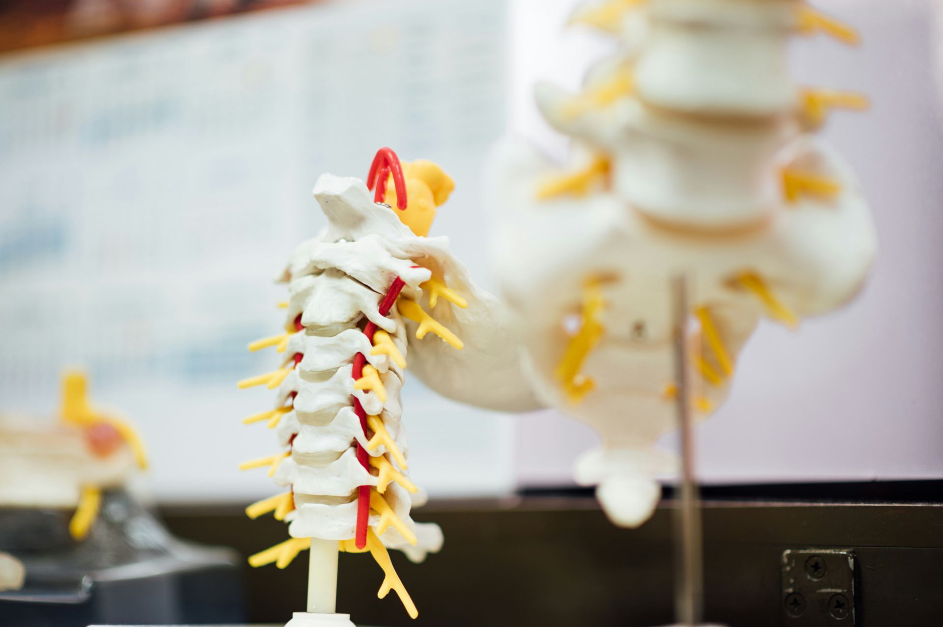 Model of a human spine with red arteries and yellow nerves, on display.