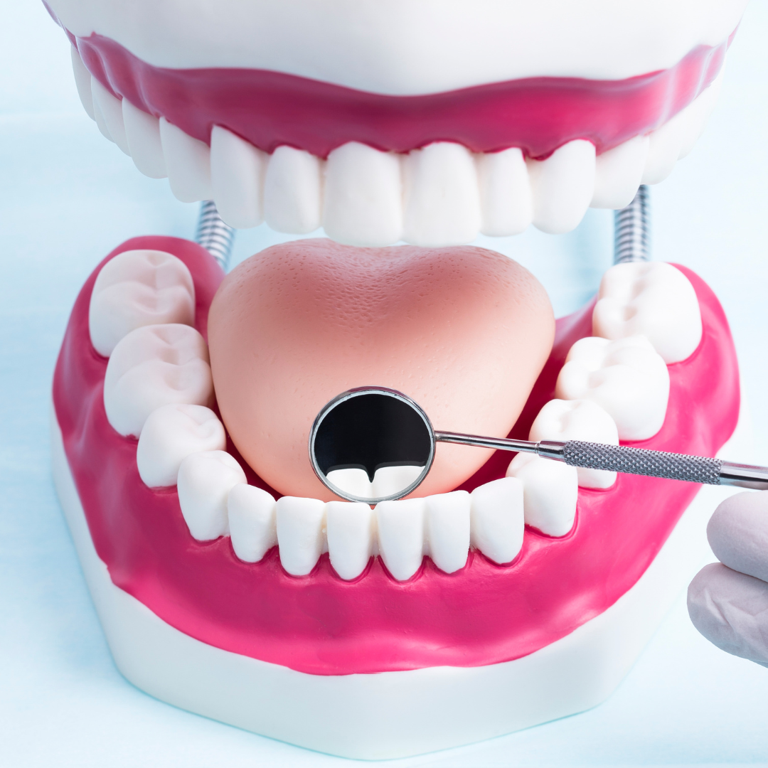 a model of a person 's teeth being examined by a dentist