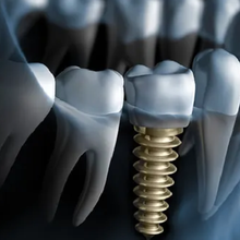 a model of a person 's teeth being examined by a dentist