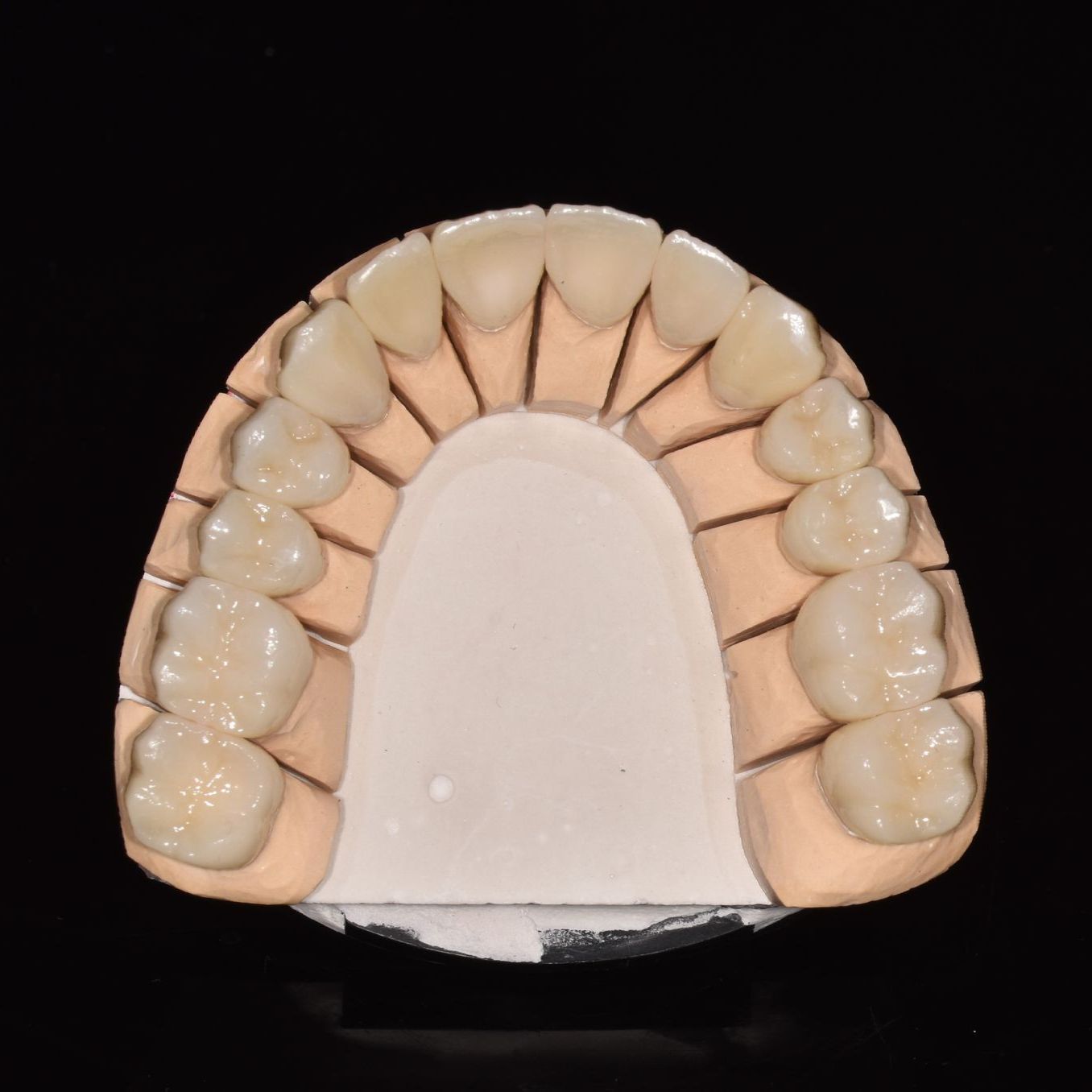 Denture Model