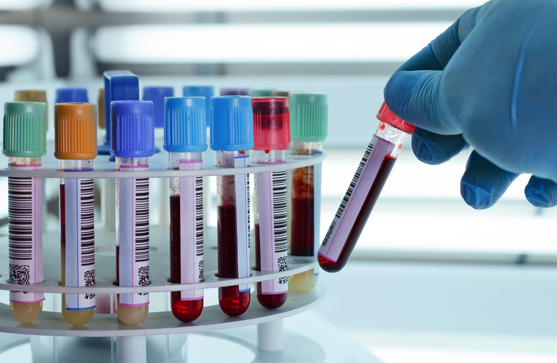 Placing blood tubes laboratory centrifuge