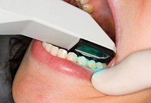 3d teeth imaging