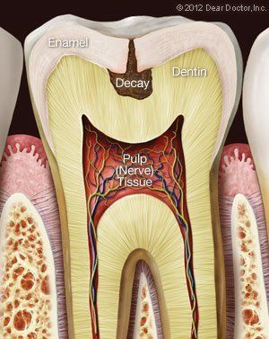 causes of tooth ache