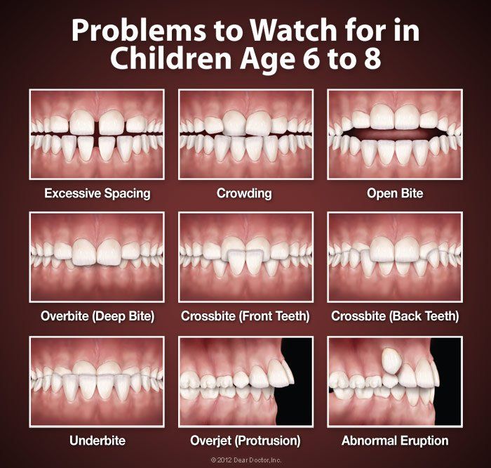 teeth problems to watch for 