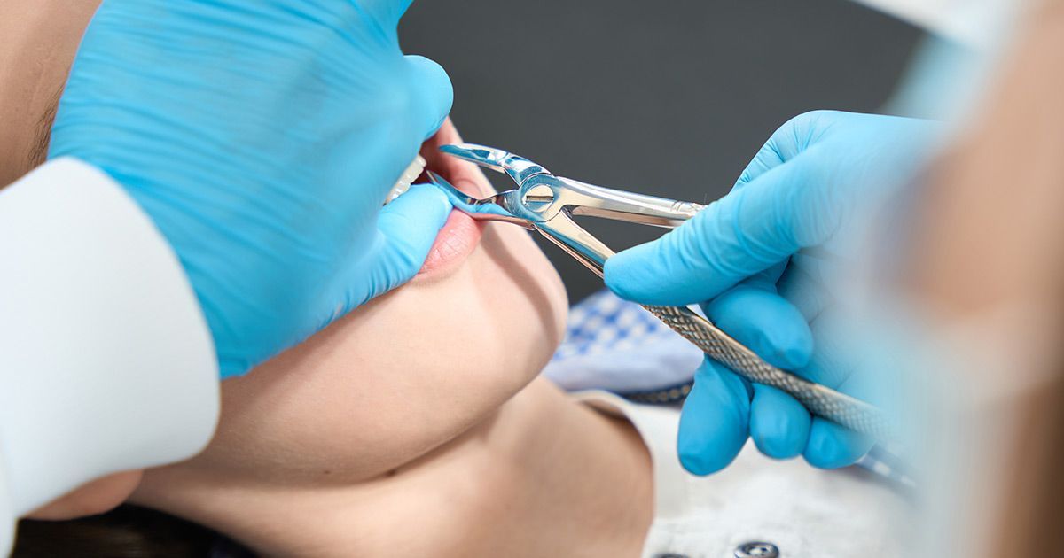 dentist working on patients tooth