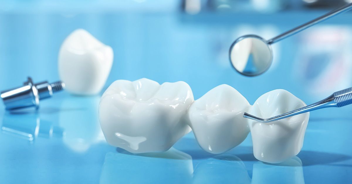 tooth replacement options