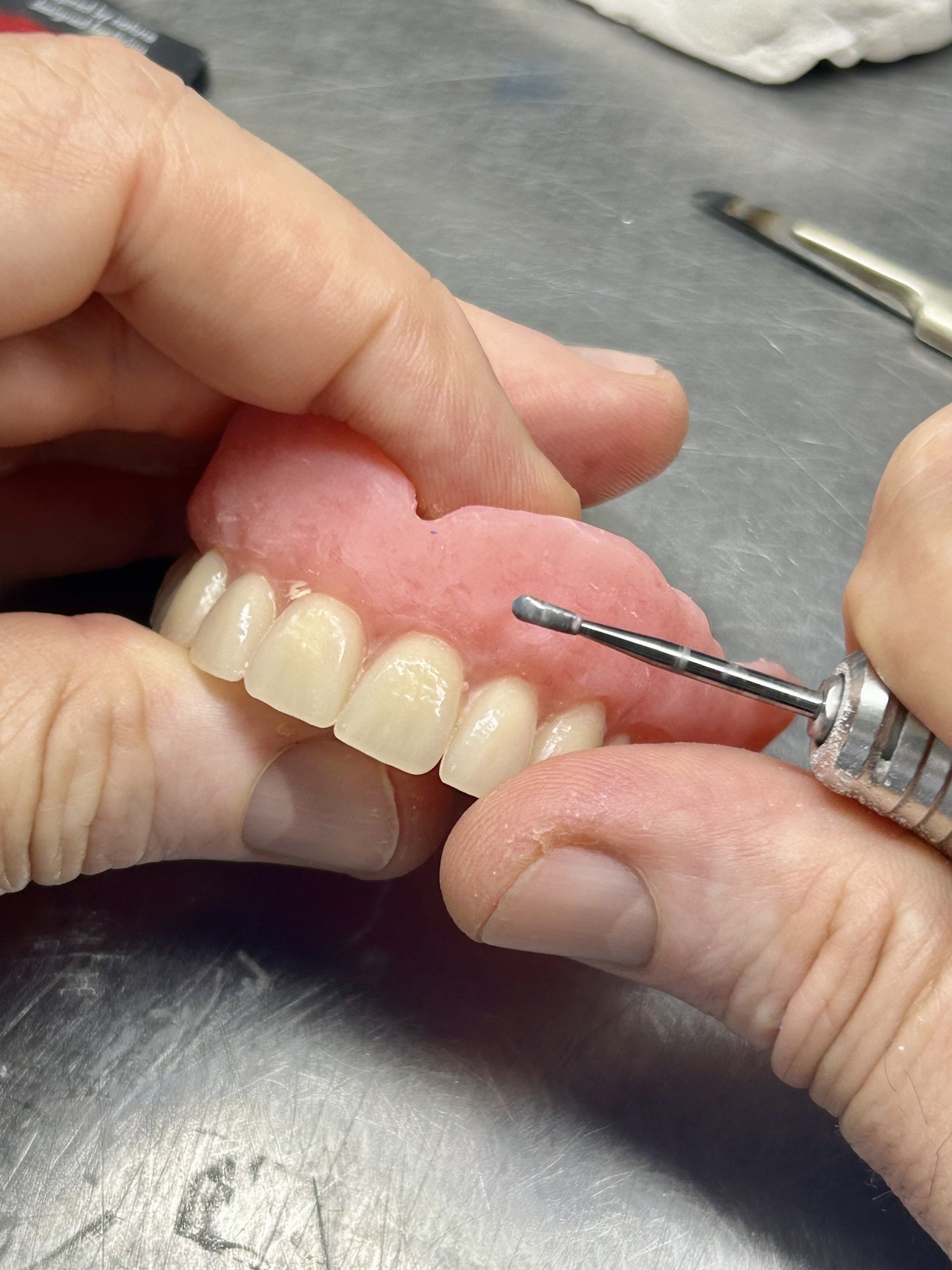 Denture Adjustments — Denture Care in Berserker, QLD