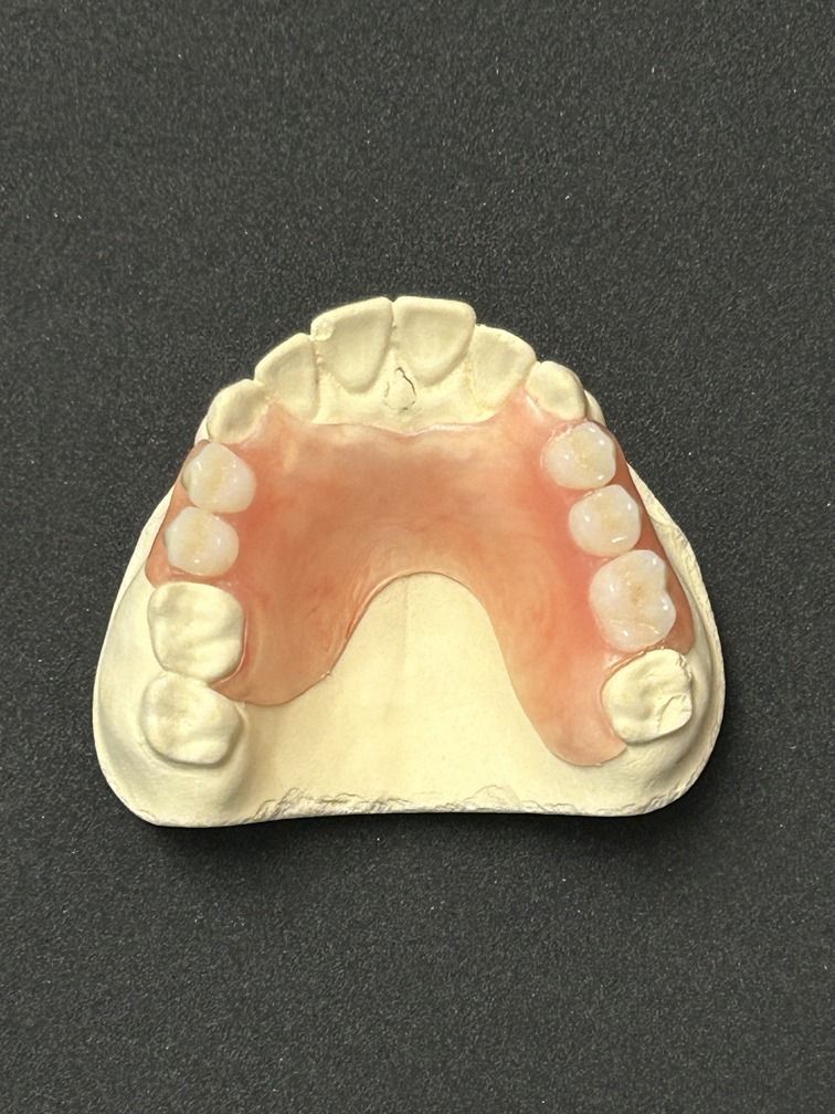 Partial Dentures — Denture Care in Berserker, QLD